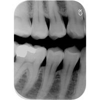 SDT-XR60 Apixia Digital Dental Imaging